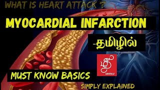 HEART ATTACK IN TAMIL  BASICS OF MYOCARDIAL INFARCTION [upl. by Enawtna]