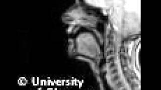 MRI voiceless alveolar fricative [upl. by Silvers]