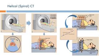 Short Topics in Computed Tomography Spiral CT Arabic Narration [upl. by Monie]