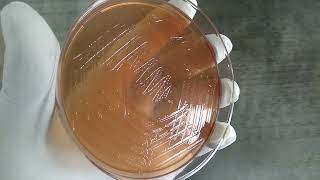 Vibrio cholerae colony morphology on Macconkey agar Demonstration [upl. by Crespo165]