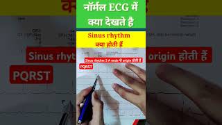 Normal ecg कैसे देखते हैं l Sinus rhythm ecgl ecg echo shorts [upl. by Lucas]