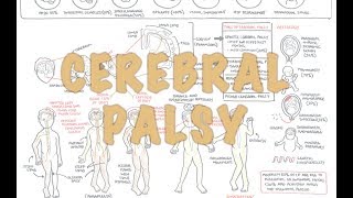 Cerebral Palsy  DETAILED Overview [upl. by Daley70]