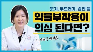 약 먹고 알레르기 나타나면 어떻게 해야 할까 약물부작용 대처법 한 방에 정리해줄게 [upl. by Ailsa]