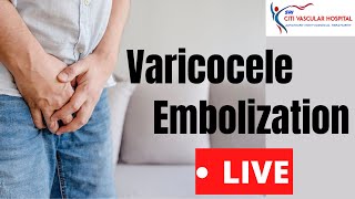 Varicocele  Varicocele Embolization Live Video in India By Varicocele Expert [upl. by Ajin182]