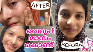 💯😳quotഎങ്ങനെ ഇത്ര glow ആയി quot My skin care products  Selmadinash [upl. by Erde]