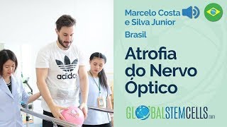 Paciente brasileiro com atrofia do nervo óptico conta sobre seu tratamento com célulastronco [upl. by Eleaffar]