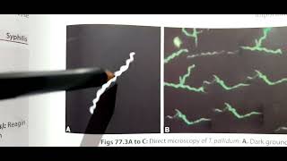 Syphilis Treponema Pallidum  Laboratory Diagnosis  NonTreponemal VDRLRPR and Treponemal test [upl. by Doroteya432]