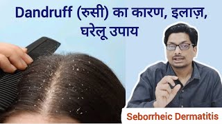 Dandruff रुसी का कारण इलाज़ घरेलू उपाय  Seborrheic Dermatitis dandruff dandruffshampoo रुसी [upl. by Meid518]