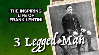 The Inspiring Life of Frank Lentini [upl. by Anillek781]