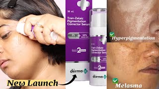 The Derma Co TranZelaic Pigmentation Corrector Serum Review  Treats Hyper Pigmentation amp Melasma [upl. by Efi]