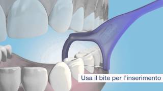 TePe Mini Flosser™ una facile e comoda pulizia interdentale [upl. by Kahl]