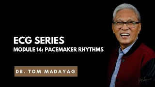 ECG Series Module 14 Pacemaker Rhythms [upl. by Ateiluj]