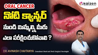 Mouth cancer treatment  నోటి క్యాన్సర్  DrAvinash Chaitanya  Kaizen Hematology Oncology Network [upl. by Arni]