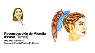 Microtia Primer Tiempo Reconstrucción con cartílago [upl. by Einahets]