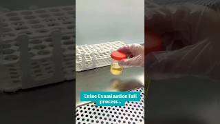 Urine exam fluid process [upl. by Lleruj282]