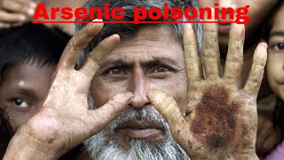 arsenic poisoning management in bangla  drarmin anwar [upl. by Nivonod]