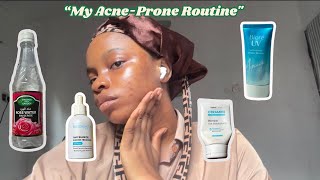 Affordable Skincare for Acne Recovery My AcneProne Routine [upl. by Maccarone558]