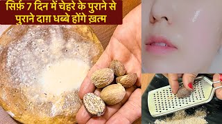 7 दिन में कितनी भी पुरानी झाइयाँ Pigmentation जड़ से ख़त्म करें Nutmeg Face pack [upl. by Elorak]