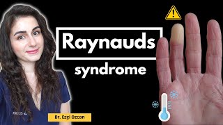 Raynauds Syndrome Causes Symptoms and Effective Management [upl. by Lesko]