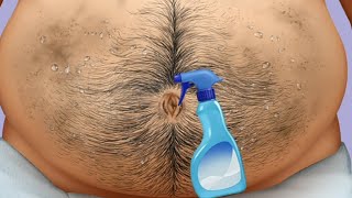 Animated Removing Huge Navel Stone  ASMR Deep Belly Cleaning Animation [upl. by Tnomed]