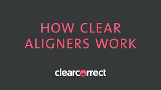 How clear aligners work [upl. by Akeimahs936]