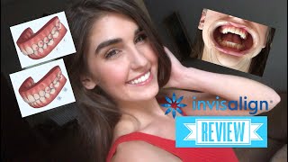 Invisalign Review Video  What They Dont Tell You Dating Kissing and MORE [upl. by Kwok783]