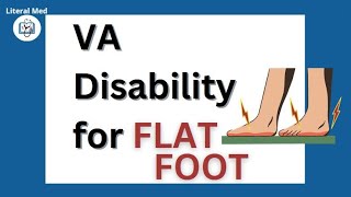 VA Disability Compensation for Flat Feet👣  Pes Planus veterans flatfeet vaclaims vadisability [upl. by Crandale670]