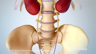 Stress Urinary Incontinence SUI [upl. by Arthur]