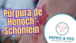 Púrpura de Henoch  Schönlein  Vasculitis por IgA  purpuradehenoch vaculitisleucocitoclastica [upl. by Jillana]