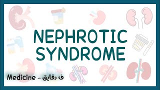 Nephrotic syndrome pathophysiology causes symptoms complications investigationsamp treatment عربي [upl. by Latihs803]