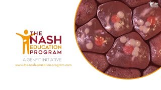 NASH liver disease progression in 3D from healthy liver to cirrhosis [upl. by Ahseekal]