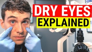 What Causes Dry Eyes Eye Doctor Explains Dry Eye Syndrome [upl. by Malanie]