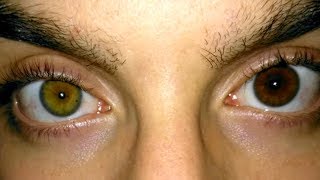 Ways Your Eye Color can CHANGE [upl. by Lacee802]