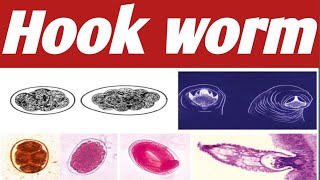 How to Get Hookworm Ahmaric Tutorial [upl. by Rina]