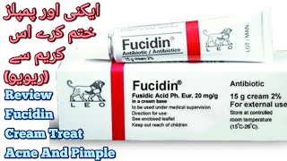 Fucidin Cream Review Fucidin Cream For Acne Scars how to clear forehead small bumps  acne youtube [upl. by Rosalynd]