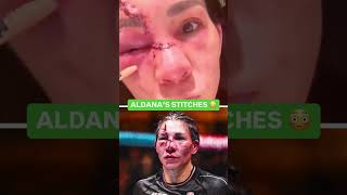 🚨Así QUEDÓ el OJO de IRENE ALDANA tras PELEA con NORMA DOMUNT en UFC 306 Shorts [upl. by Anana]