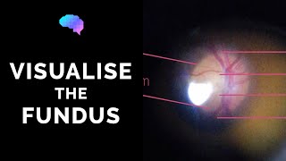 Fundoscopy  How to Visualise the Fundus  Direct Ophthalmoscopy  OSCE Guide  UKMLA  CPSA [upl. by Pierro]