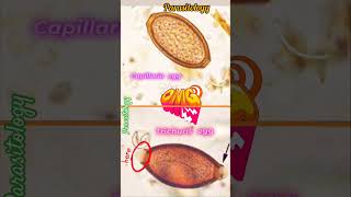 Capillaria egg amp Trichuris egg 👍Parasitology👍🤔📚🔬✅ [upl. by Ark]