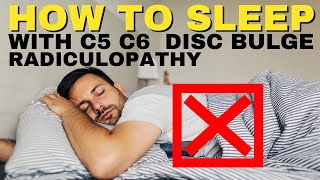 Ep19 How To Sleep With C5 C6 Disc Bulge Radiculopathy  Dr Walter Salubro Chiropractor in Vaughan [upl. by Yunfei870]