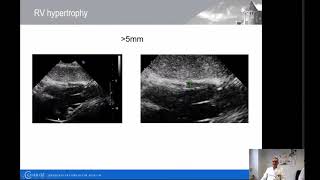 Echokardiographie bei Pulmonaler Hypertonie  Charité  Prof Dr med Frank Edelmann [upl. by Eelyk]