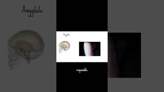 Brain beans amygdala brains [upl. by Eitisahc]