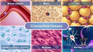 Understanding Soft Tissue Sarcoma [upl. by Allie493]