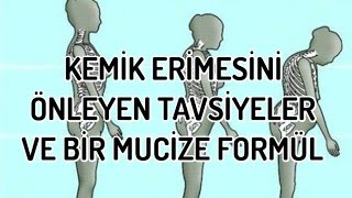 KEMİK ERİMESİNİ ÖNLEYEN TAVSİYELER VE BİR MUCİZE FORMÜL [upl. by Lubow]