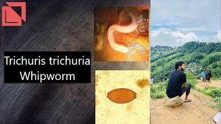 parasitology Trichuris trichura Whipworm norcet microbiology labtechnician mltlab [upl. by Bulley235]