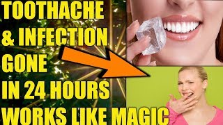 HOME REMEDIES FOR TOOTH INFECTION SEVERE TOOTHACHE REMEDY  HOW TO STOP TOOTH PAIN FAST [upl. by Mandle154]