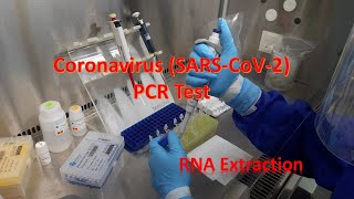 Coronavirus RNA Extraction pooling of samples for testing SARSCOV2 [upl. by Rolyt]