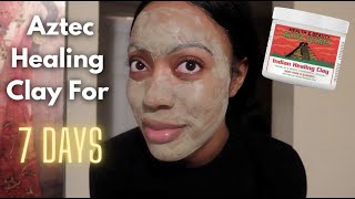 I USED THE AZTEC HEALING CLAY MASK FOR A WEEK  Acne Journey  RelliKay [upl. by Janyte]