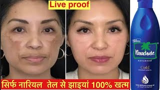 नारियल तेल में बस 1 चीज़ मिलने से झाइयों को जड़ से ख़त्म करें Pigmentation Removal [upl. by Eltsyrhc]