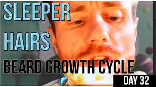 Sleeper Hairs amp How they will IMPROVE your Beard GAME Hair Growth Cycle  Thin Patchy Advice [upl. by Nnylasor]