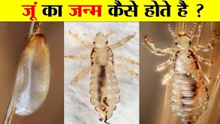 देखिए बालों में कैसे जू का जन्म होता है  Facts about lice in Hindi [upl. by Erdnaek133]